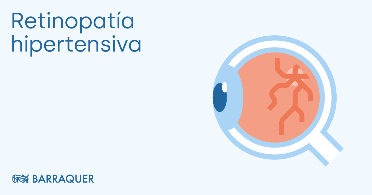 retinopatía hipertensiva vs normal